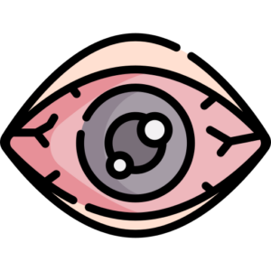 doctor checking optic nerve and uvea inflammation