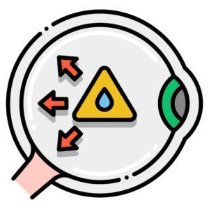 tonometry test for glaucoma screening