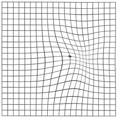 Amsler grid