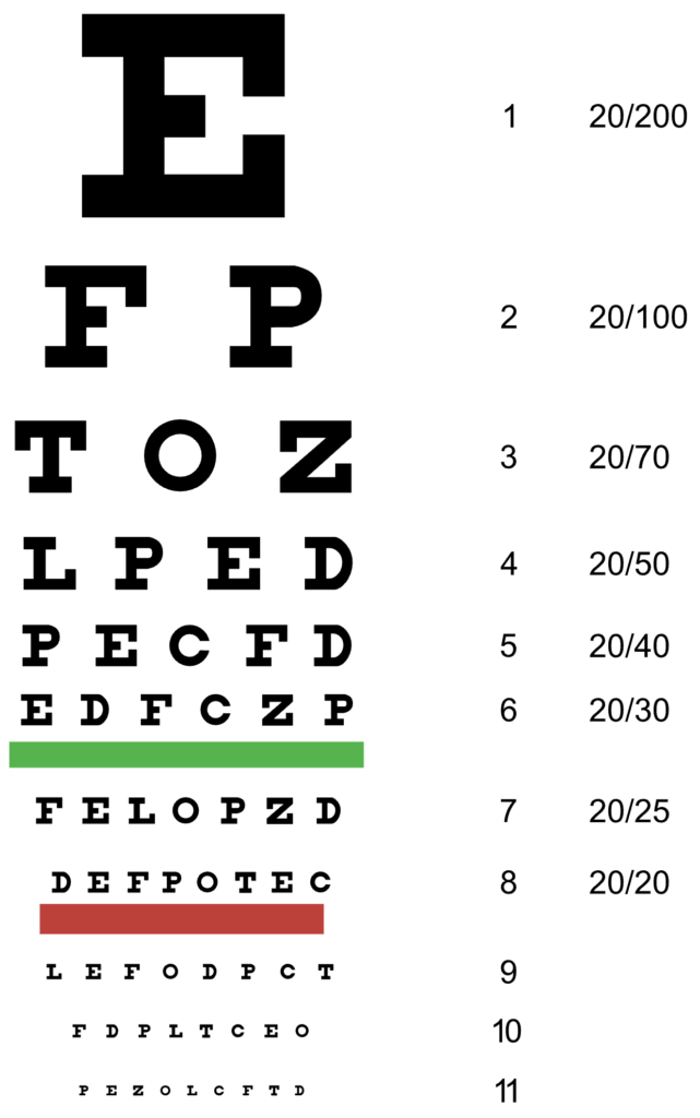 Eye check up bhopal